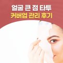 모반개발 | 오타 모반 얼굴 큰 점 커버 타투 스킨마크 고객님의 후기