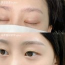 아인뷰티의원 이미지