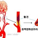 대뇌(Cerebrum)| 이미지