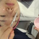 세정피부관리실 | 두정동피부관리실 오마주21 모공관리 재생관리 받고 달라진 피부 후기