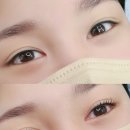 요니뷰티 이미지
