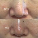 경희사랑채한의원 | 부산 모공 관리는 사하구 하단 리빛메디스킨에서