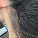 수완하얀피부과의원 | [목포역 점 잘빼는 곳 추천] 하얀피부과의원_후기&amp;재생크림