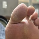 매료네일in뷰티 | 부산 서면역 발각질 제거 대만족한 매료네일in뷰티 후기