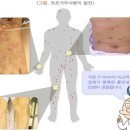 혈액암 투병 팔백쉰두(852) 번째 날 편지, 2 (음식, 건강) - 2023년 1월 6일 금요일 이미지