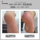 레푸스죽전새터점