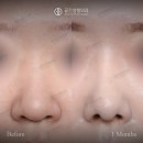 비주