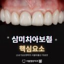 서울열린치과 이미지