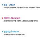 지구치과기공소 이미지