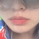 갈더마코리아 노동조합 | [레스틸렌 키스 서포터즈] 생기 있는 입술을 위한 솔루션 💋