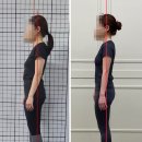 솔(SOL)메디 네이버블로그