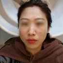 로모헤어스파살롱 명지점 새치커버(헤나염색후 일반염색)