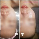 금당피부관리