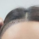 압구정케어맘
