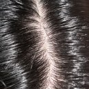 촘촘 스칼프 이미지