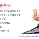 발목충돌증후군, 족근동증후군, 후경골건염 이미지