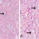 웨이브의원 이미지