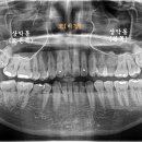 바른윤치과의원 이미지