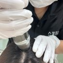 세종라이프 | [세종 나성동] 세종탈모~스칼프리온 나성점, 두피관리 솔직 리뷰 후기