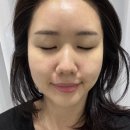 송파피부관리 보라다움 - 문정 최초 미용기기 합법레이저 닥터밸루 6세대 엑소 부스터 관리
