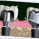 건강한치과의원 | 스케일링 잘하는 군자역 치과, 서울든든한치과 후기 - 건강한 치아의 비밀