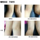 셀라 스킨케어 네이버블로그