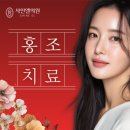 조  치 이미지