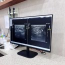 고양이 구토형 IBD 염증 치료 스테로이드 고민과 케어