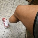 여기 | 피부과 대신 여기, 찐 후기