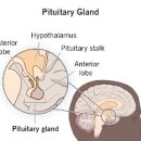 뇌하수체 종양 및 (선종, ) 이미지