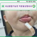 박종필성형외과 네이버블로그