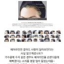 투투헤어라인 이미지