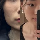 더 끌림 | 예비신부 웨딩관리 - 더끌림뷰티 후기(f. 윤곽, 어깨, 승모 마사지)