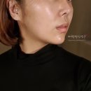 아르케스파 홍대점 | 아르케스파 홍대점, 어웨이크닝 리설페이싱 솔직후기(ft.시스올로지)