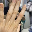 인산한의원 | 류마티스 관절염 임신 출산 후기