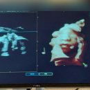 광교은산부인과의원 이미지