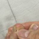 나의발톱일기