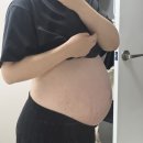 부천삼성요양병원 | 드디어 설기를 만난 날❤️ 초산모 유도분만 후 제왕절개 후기(부천삼성미래산부인과)