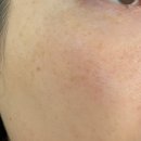 유앤아이의원 | 유앤아이의원 목동점 : 클라리티 1회 내돈내산 후기