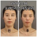 라라에스떼 네이버블로그