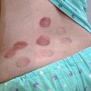 세종한방병원 | 세종시 하이한방병원 임산부 교통사고 입원후기😥