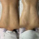 은가비 | 대구신부관리 달서구 통증관리 어깨•등 한 번에 관리받은 솔직후기 은가비 피부관리