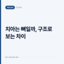 슬기로운 군산치과의원 | 치아는 뼈일까 아닐까, 구조를 알면 평소 챙길 습관이 보입니다