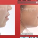 연세엘라인치과의원 네이버블로그