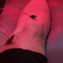 금한의원 이미지