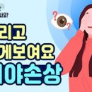 실명 전조 한쪽눈 실명 장애등급 한쪽눈 시력저하 이미지