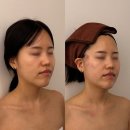 대동씨코아경로당 | 에스테틱, 퍼펙트 볼륨 리프팅 후기 : [마산, 해운동] ‘쎌뷰티‘