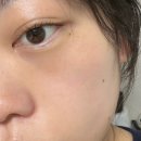 오렌지스킨 | [SKINCARE] EGF 고함량 스킨이치 오렌지 세럼 피부결 관리 솔직 후기