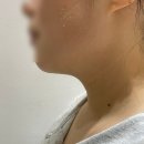 리주 네일 | 양산 실루엣리프팅 이중턱 관리 온스에스테틱 비포에프터 있음