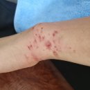 아세아정형외과의원 이미지